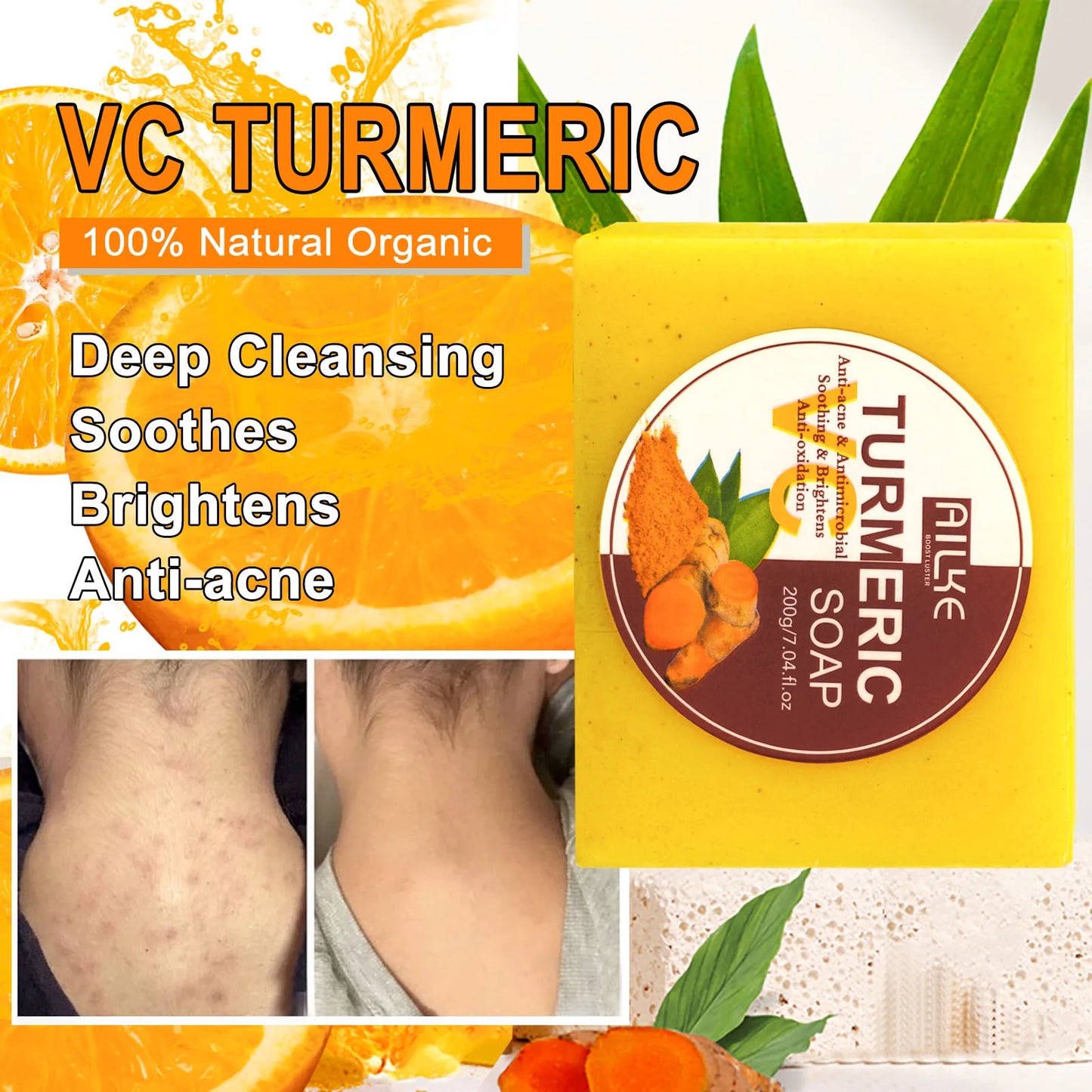 AILKE Aloe Vera Whitening Soap Acne Removal Radiant Skin