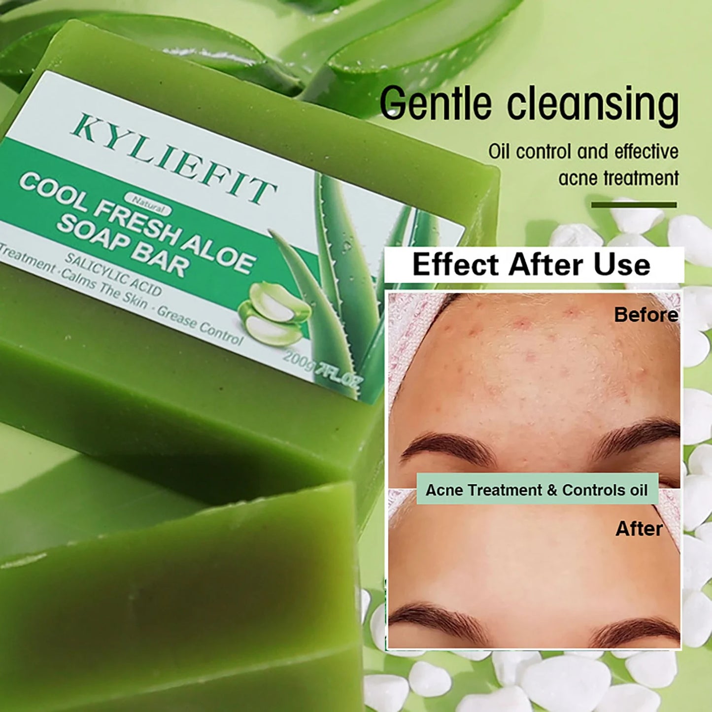 AILKE Aloe Vera Whitening Soap Acne Removal Radiant Skin