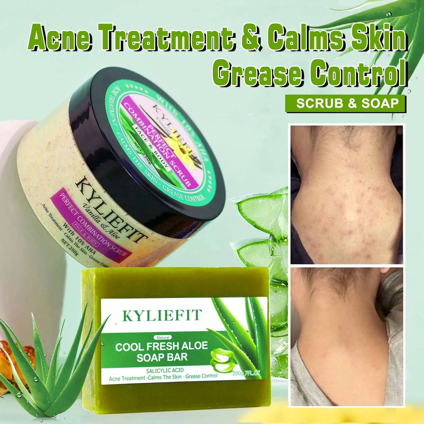 AILKE Aloe Vera Whitening Soap Acne Removal Radiant Skin